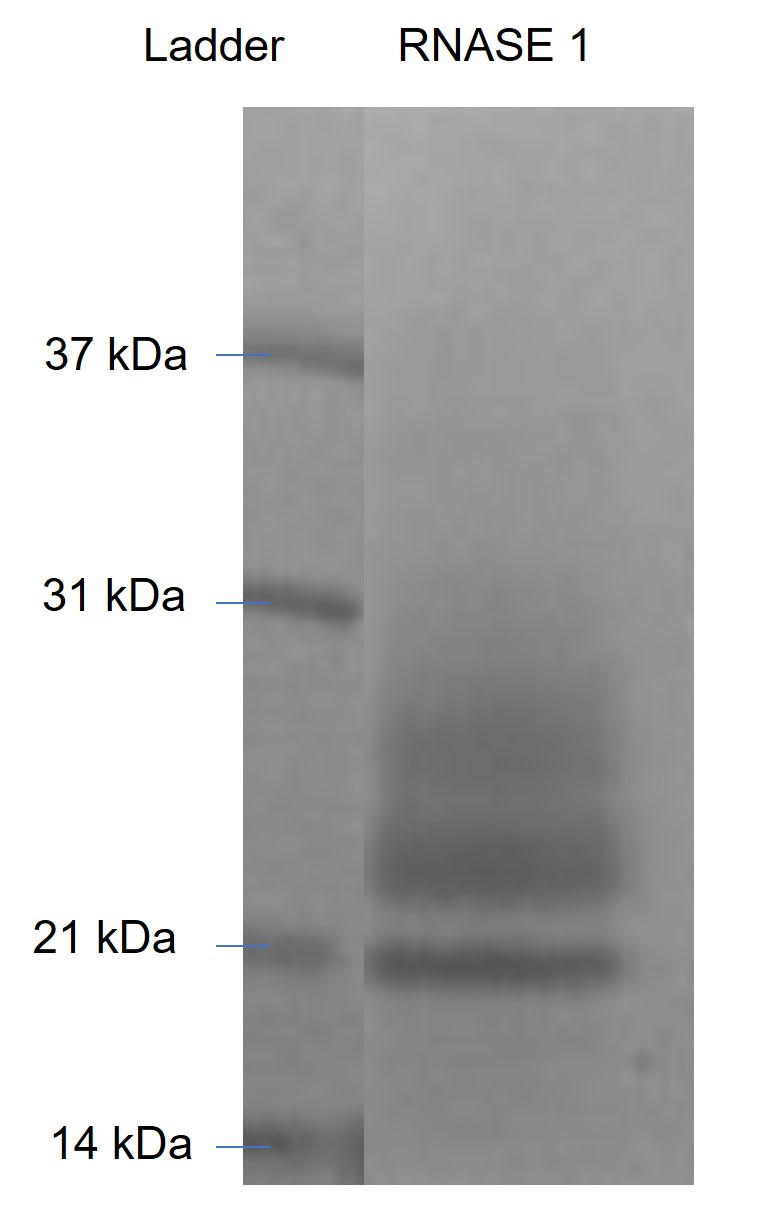 Recombinant Human Ribonuclease Pancreatic/RNASE1 (C-6His)